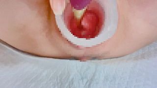 Japanese  Toys Dildo  Gaping Widen Expansion Dilatation  Cervix Squirt